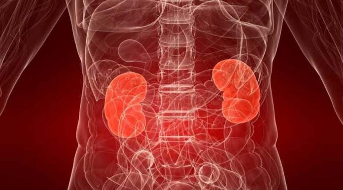 Remedii naturiste pentru pietrele la rinichi