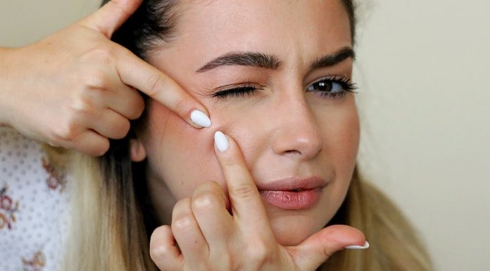 Cele mai eficiente modalitati de a scapa de acnee