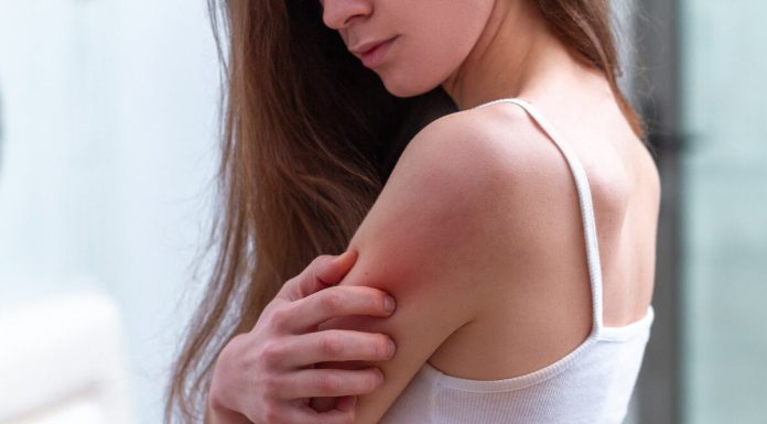 Ce sunt muscaturile de purici si cat dureaza?