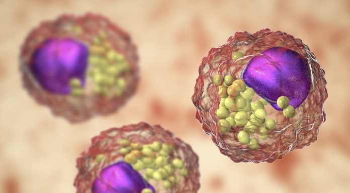 Lipide: ce sunt, tipuri si functii