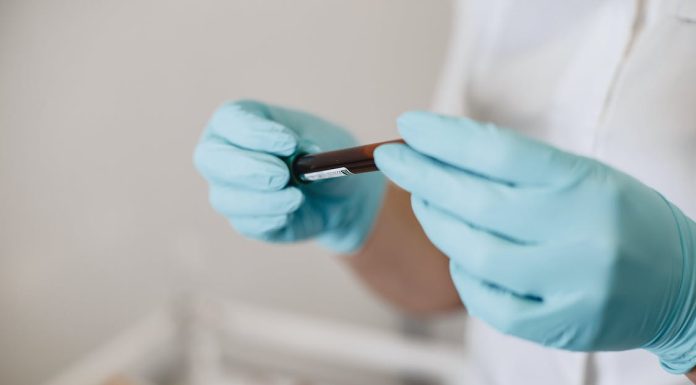 Cum putem imbunatati circulatia sanguina: 3 metode